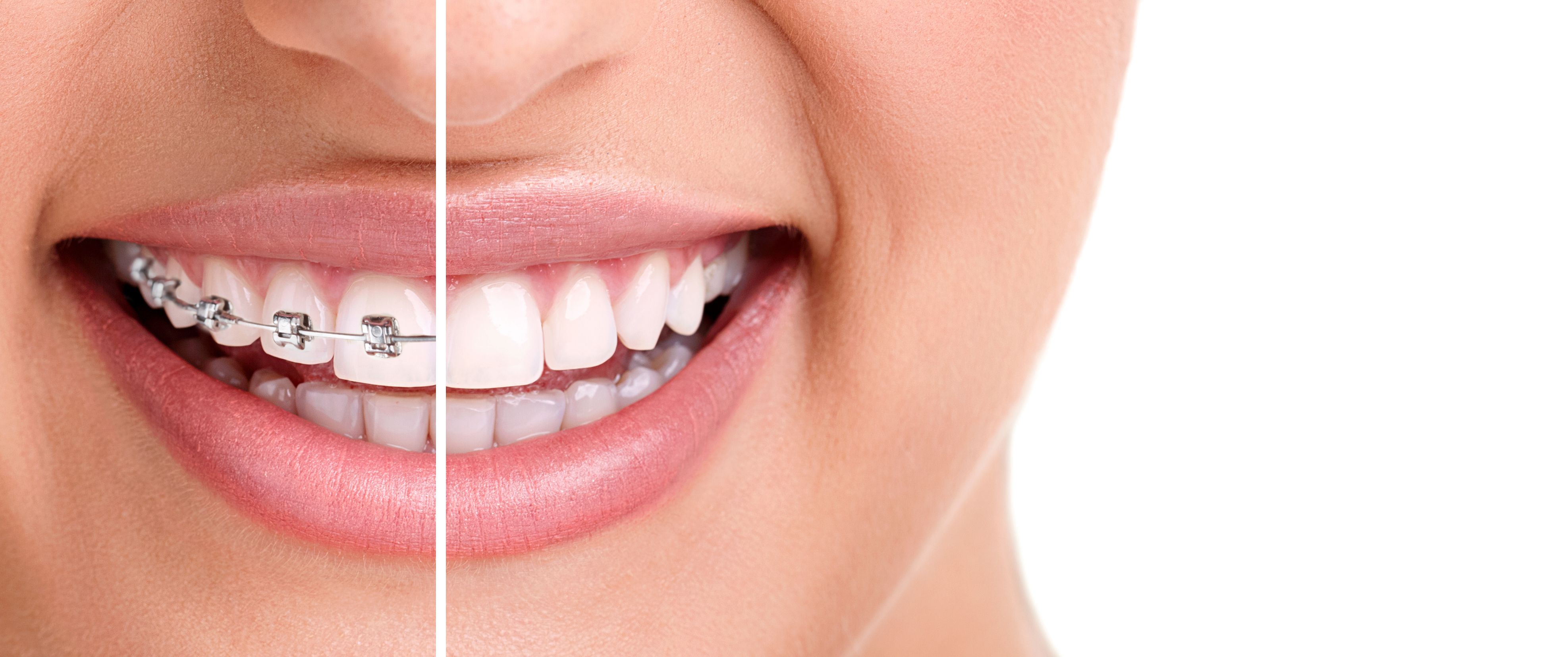 Ortodoncia Dental